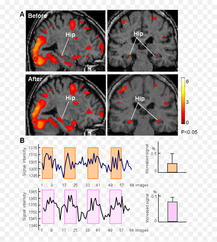 The Relationship Between Mastication And Cognition Intechopen - Dot Emoji,Cognition Vs Emotion