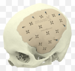 Custom Implants Xilloc Emoji,Face And Emotion Skull