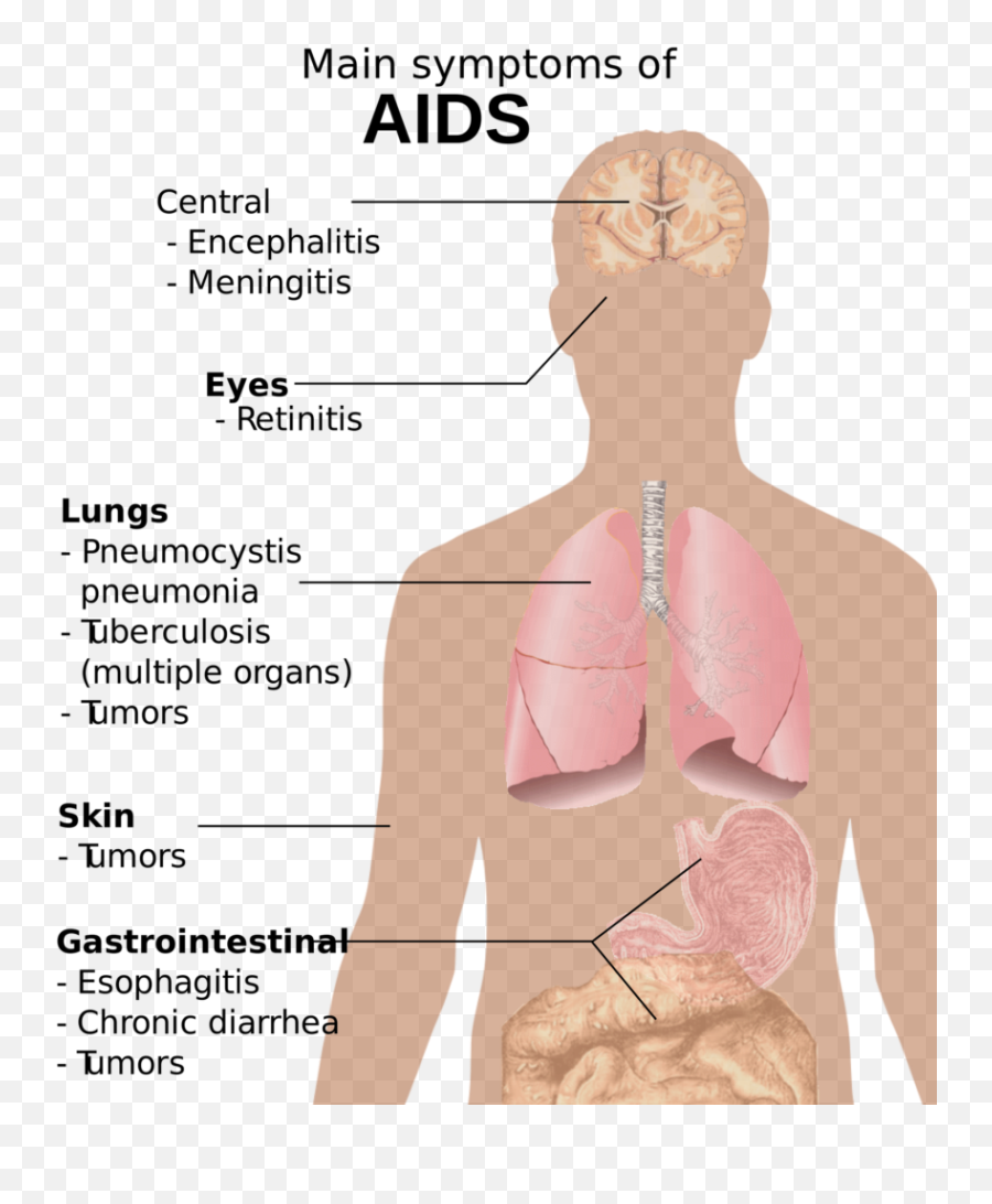 Nausea Smiley Kotzender Vomiting Public Domain Image - Freeimg Long Can You Live With Aids Emoji,Emoticons Muscles