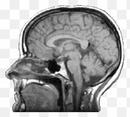 Nicoladie Tam Research - Brain Scan Transparent Background Emoji,Brain Scans Of Emotions