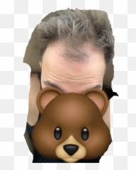 Hlc Hairtransplant Nw3 3000 Grafts - Hair Restoration Happy Emoji,Emoji For Keeping Fingers Crossed