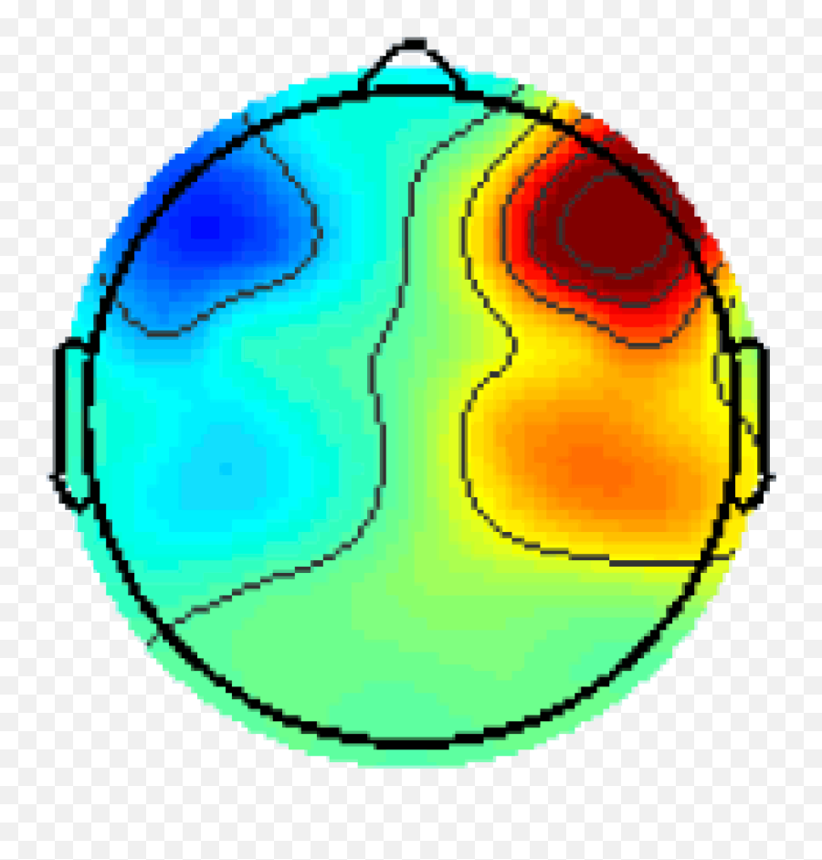 Prefrontal Asymmetry Effects On Affect And Cognitive Performance - Frontal Alpha Asymmetry Depression Emoji,Cognitive Emotion