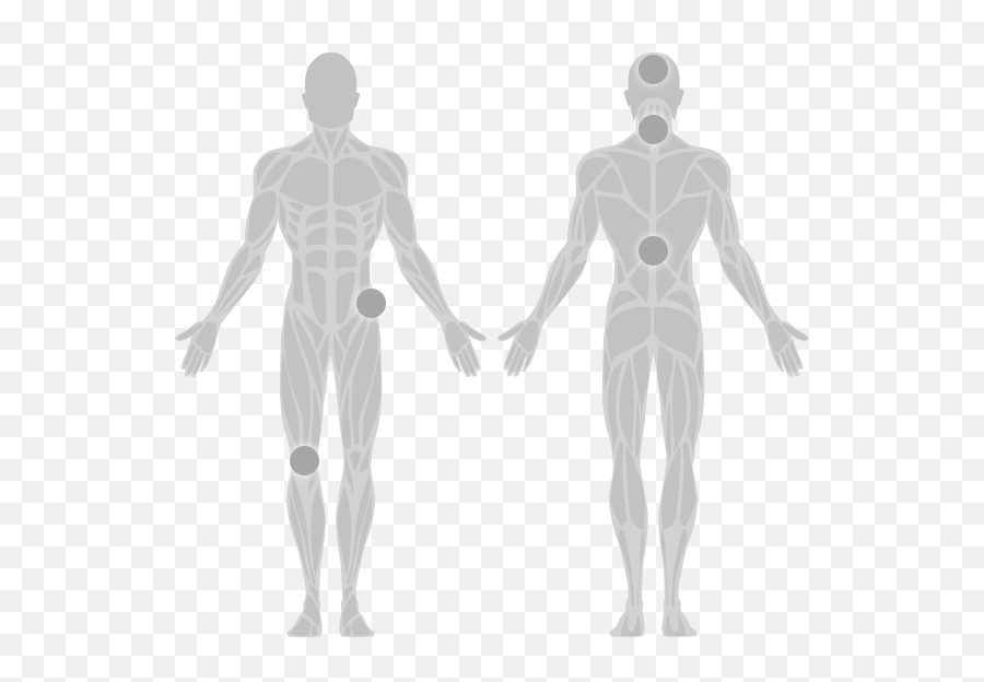 Center For Interventional Pain And Spine - Low Back Emoji,Blank Body Map Emotions