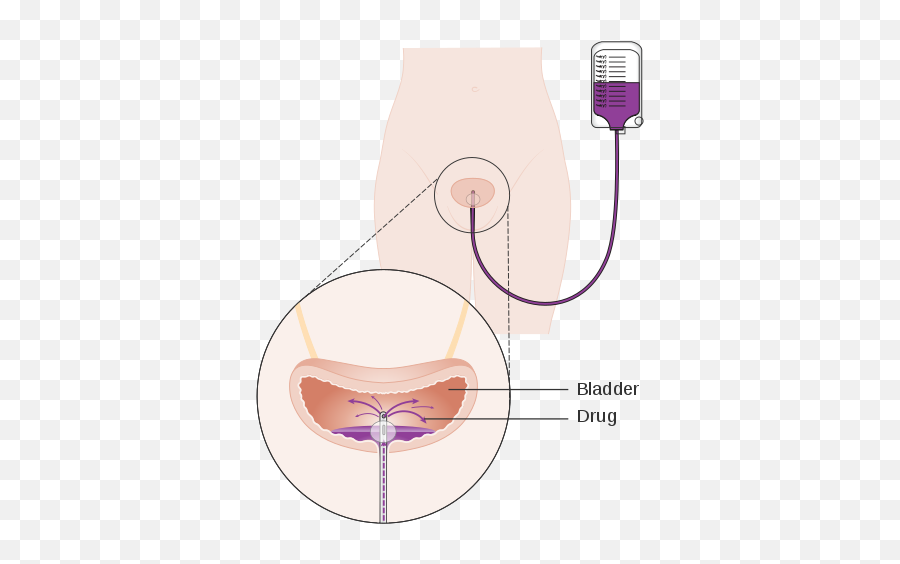 Bladder Cancer - Vertical Emoji,Sayer Ji On Emotion And Bladder