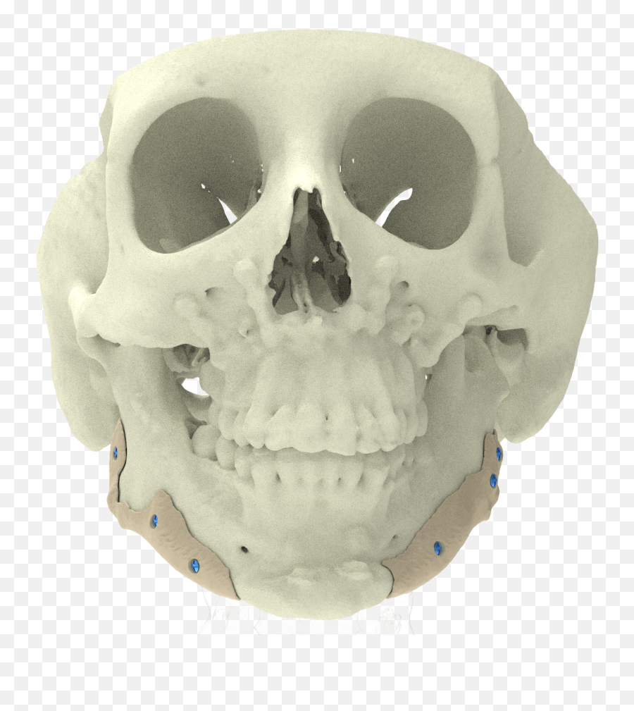 Custom Implants Xilloc Emoji,Skulls That Can Show Emotion