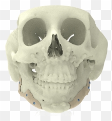 Custom Implants Xilloc Emoji,Skulls That Can Show Emotion