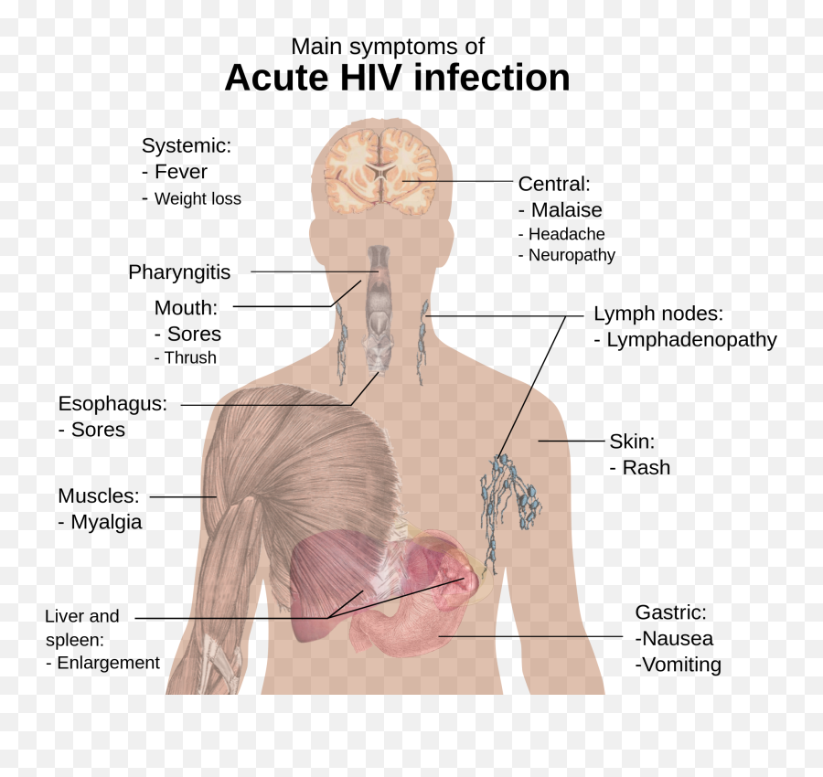 Signs And Symptoms - Wikipedia Main Symptoms Of Acute Hiv Infection Emoji,Emotion Sickness