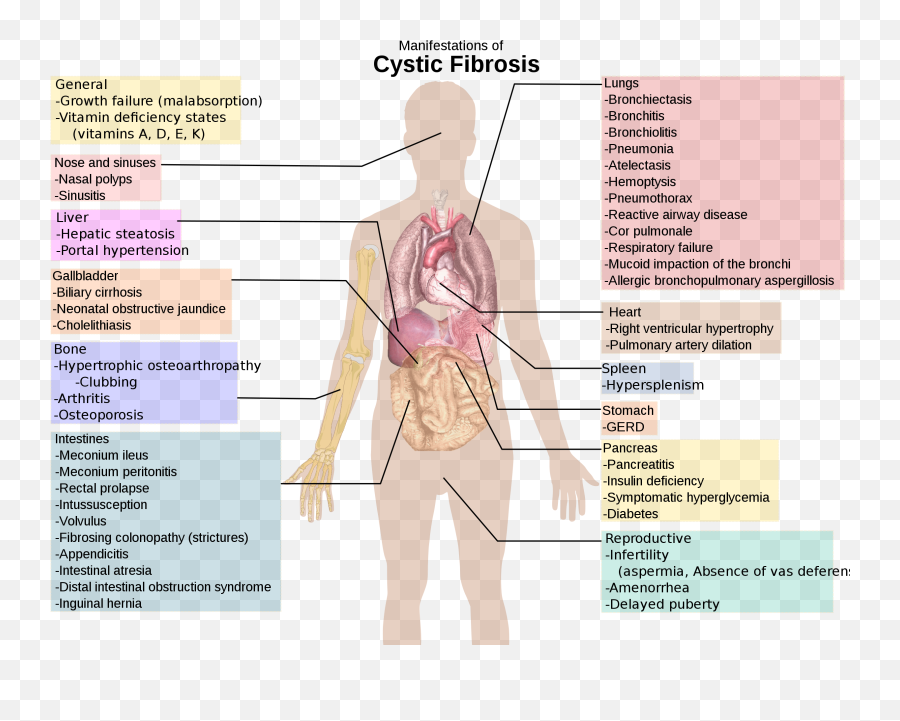 Motivation And - Cystic Fibrosis Mycobacterium Abscessus Emoji,Spleen Emotion