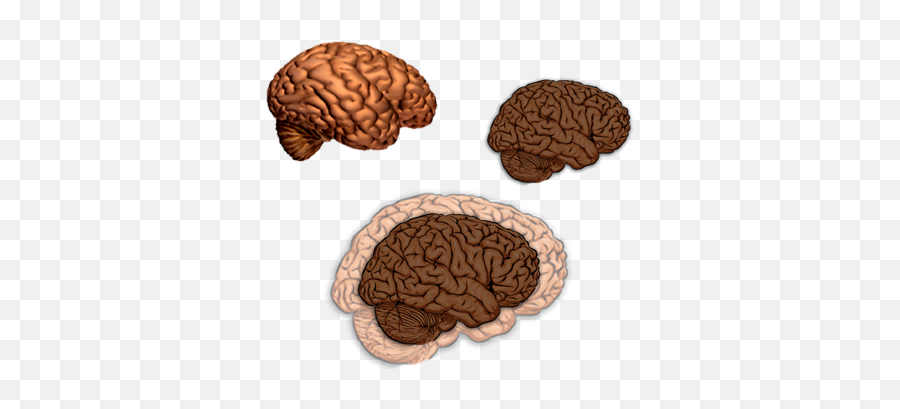 Alzheimers Disease Histology Of Alzheimers Disease - Pain Pathway Multimodal Analgesia Emoji,Parts Of The Limbic System Involved In Emotion