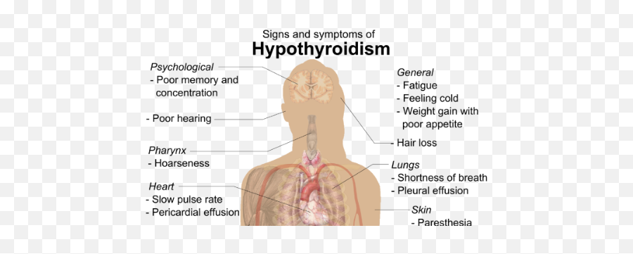 Thyroid Treatment In Homeopathy - For Adult Emoji,Thyroid Medication And Emotions