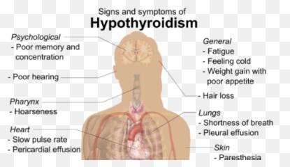 Thyroid Treatment In Homeopathy - For Adult Emoji,Thyroid Medication And Emotions