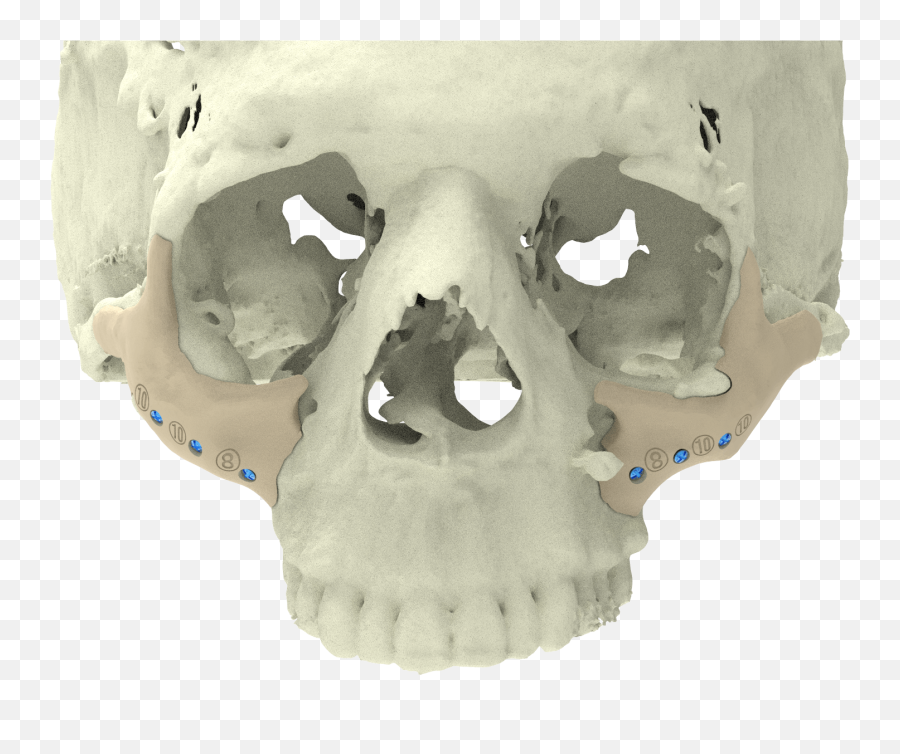 Custom Implants Xilloc Emoji,Face And Emotion Skull