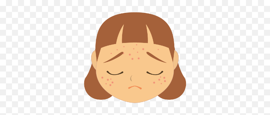 Get Rid Of Acne Fast Using Traditional Indian Methods - Face Acne Cartoon Png Emoji,Stubborn Emotion Cartoon