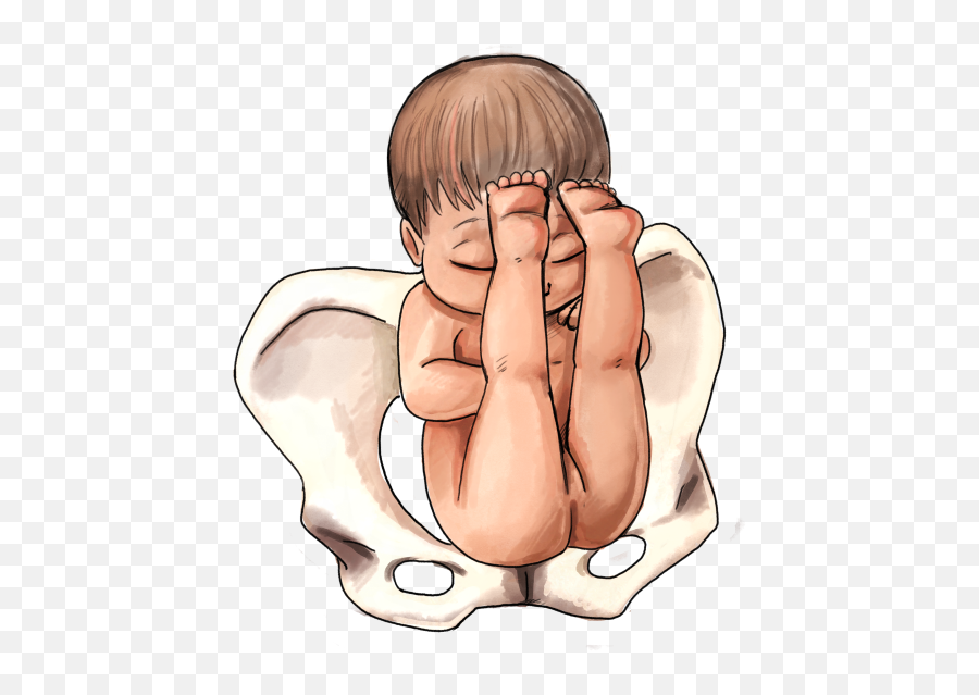 Picture - Baby Position In Womb Frank Breech Emoji,Fetal Position Emoji