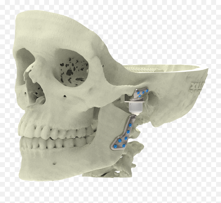 Custom Implants Xilloc Emoji,Face And Emotion Skull