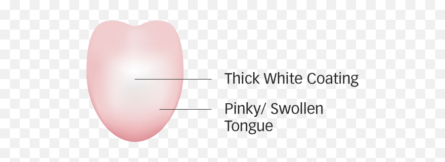 What Your Tongue Reflects About Your Health - Pulse Tcm Emoji,Small Tongue Out Emoticon Face