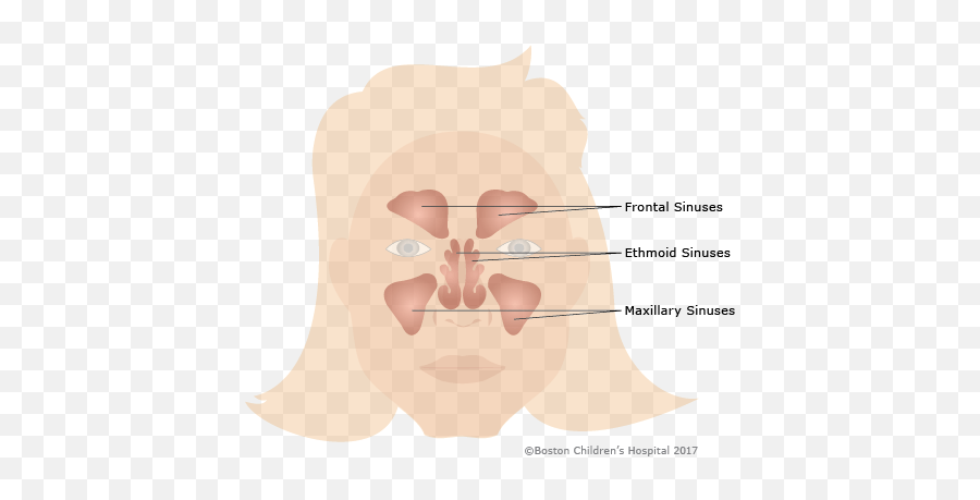 Sinusitis - For Adult Emoji,Facial Emotion Traps