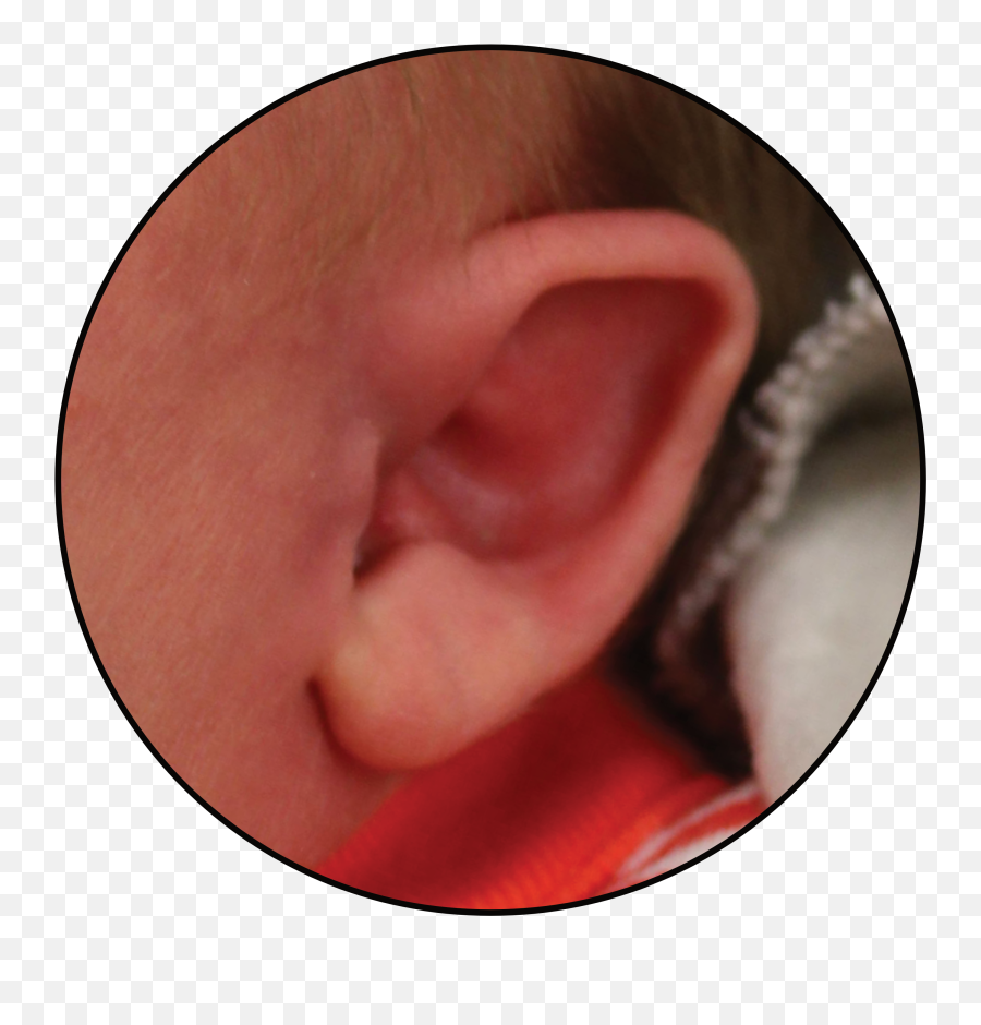 Earbuddies Reviews U0026 Results By Parents Ear Of The Month Emoji,The Emotion Borns