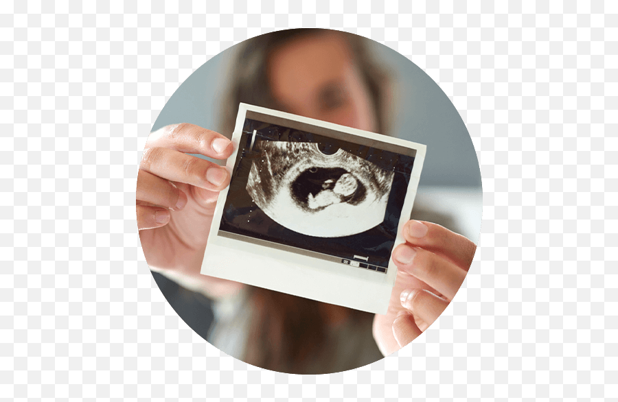 Pregnancy Resources - Medical Imaging Emoji,Ultrasound Of Babys Reactions Emotions