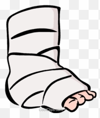 Broken Ankle - Transparent Leg Cast Clipart Emoji,Broken Leg Emoji