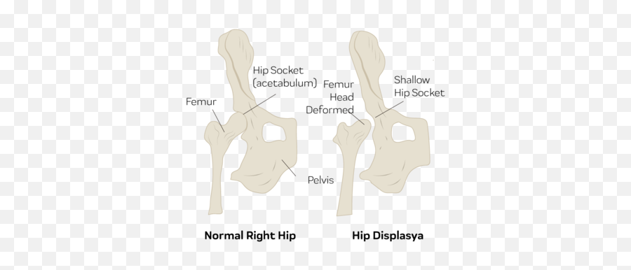 Hip Dysplasia In Dogs - Innovet Pet Dot Emoji,Emotions For Hip Hurting