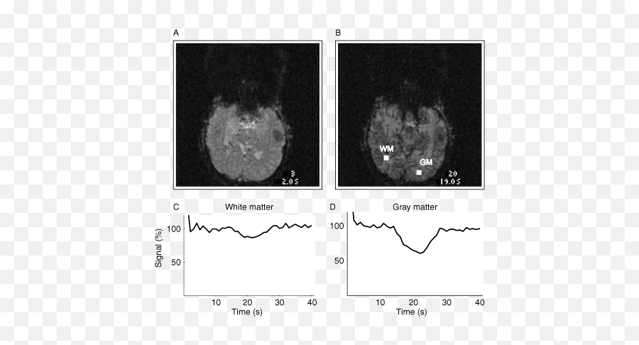 Functional Magnetic Resonance Imaging - Medical Imaging Emoji,Our Culture Has Restricted Emotions Never South Of Skull Heaps Of Cemicals In Spinal Cord