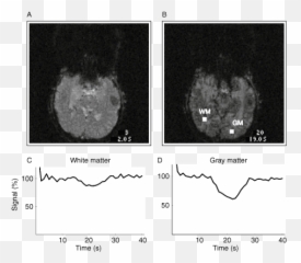 Functional Magnetic Resonance Imaging - Medical Imaging Emoji,Our Culture Has Restricted Emotions Never South Of Skull Heaps Of Cemicals In Spinal Cord