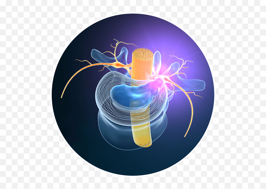 Do I Need A Spinal Cord Stimulator - Art Emoji,Emotion Inserts Carly