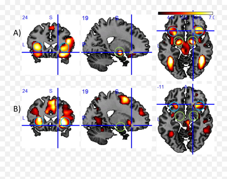 A7 U2014 Sfb 9403 - Volition And Cognitive Control U2014 Tu Dresden Emoji,Emotional Reactivity Vs Emotion Regulation