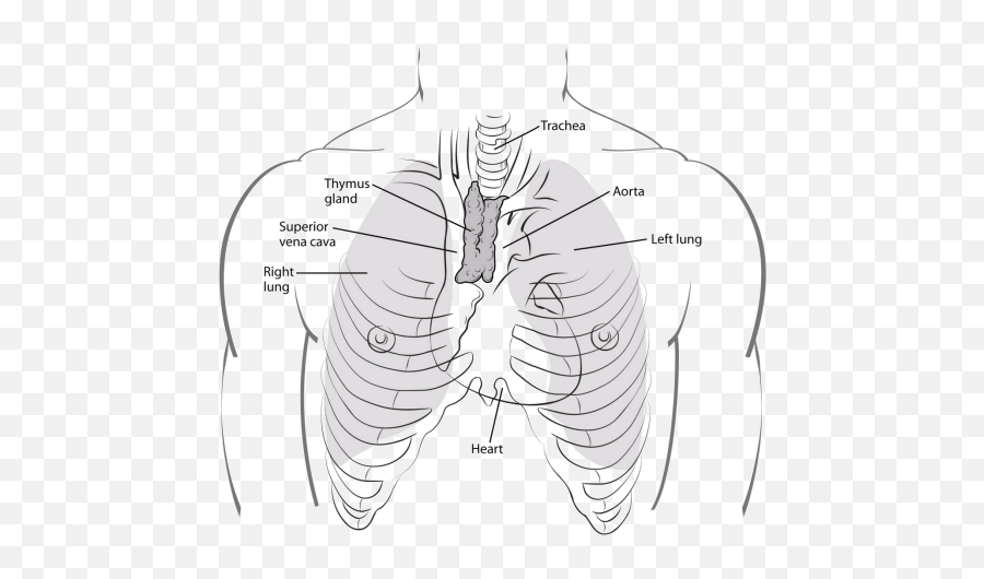 Signs And Symptoms Of Acute Lymphocytic Leukemia All - Thymus Gland And Superuo Vena Cava Emoji,Printable Black And White Sweating Emotion Face