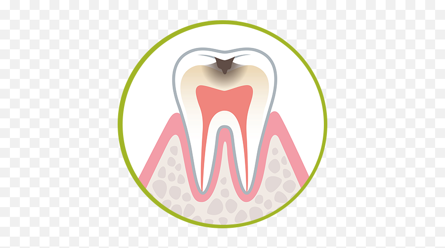 Addressing Childhood Cavities With The Right Approach - Struktur Organisasi Uks Tingkat Smp Emoji,Laughing Emoji With Braces