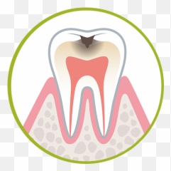 Addressing Childhood Cavities With The Right Approach - Struktur Organisasi Uks Tingkat Smp Emoji,Laughing Emoji With Braces
