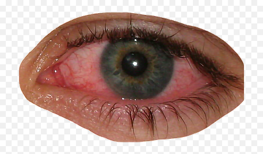 Eye Bloodshot Blood Redeye Sticker - Bloodshot Eyes Png Meme Emoji,Emoji With Bloodshot Eyes