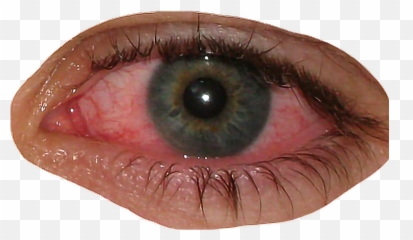 Eye Bloodshot Blood Redeye Sticker - Bloodshot Eyes Png Meme Emoji,Emoji With Bloodshot Eyes