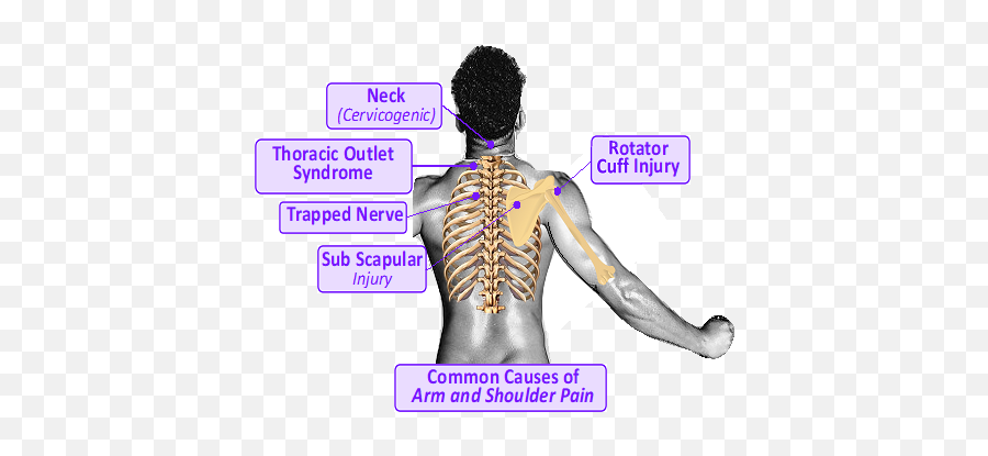 Pain Near Left Shoulder Joint - Cure Of Rotator Shackle Shoulder Nerve Pain Emoji,Emotions Shoulder Pain