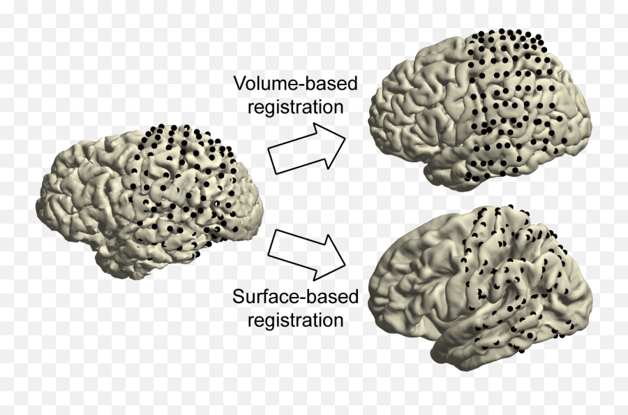 Analysis Of Human Ecog And Seeg Recordings - Fieldtrip Toolbox Dot Emoji,Brain Figure Key Brain Structures Involved In Processing Emotion