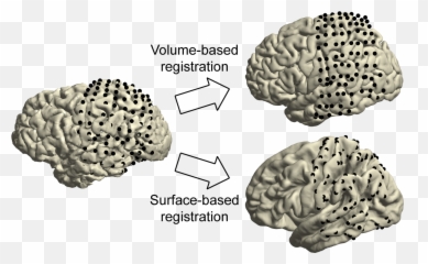 Analysis Of Human Ecog And Seeg Recordings - Fieldtrip Toolbox Dot Emoji,Brain Figure Key Brain Structures Involved In Processing Emotion