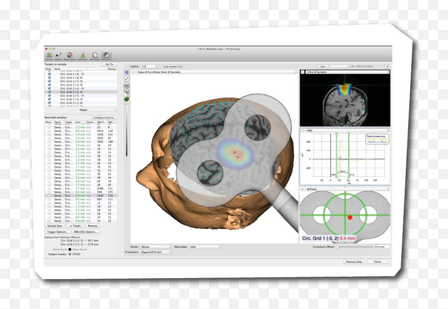 Brainsight Tms Navigation Products Brainbox - Tms Navigation Emoji,The Emotion Code The Sway Test