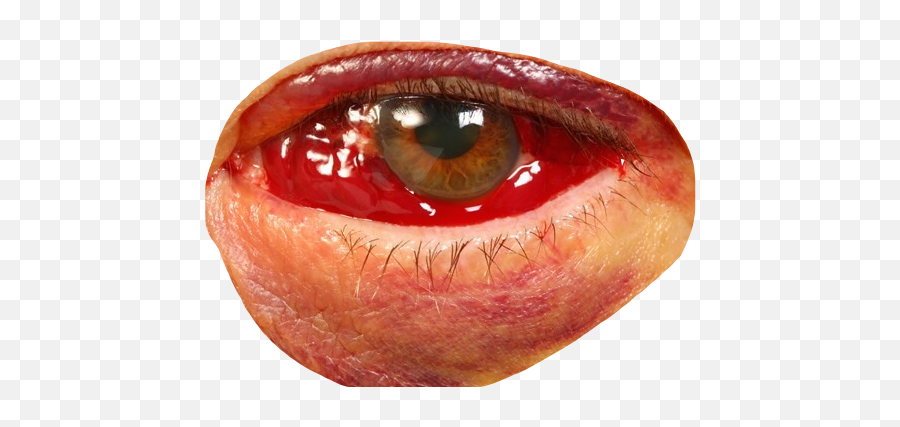 Eye Bloodshot Blood Redeye Sticker - Blood Shot Eyes Png Emoji,Emoji With Bloodshot Eyes