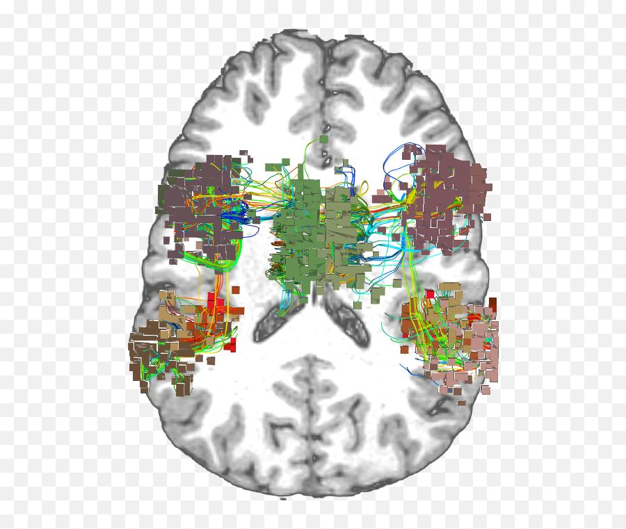 Brain Networks - Language Emoji,Brain Emotion Map
