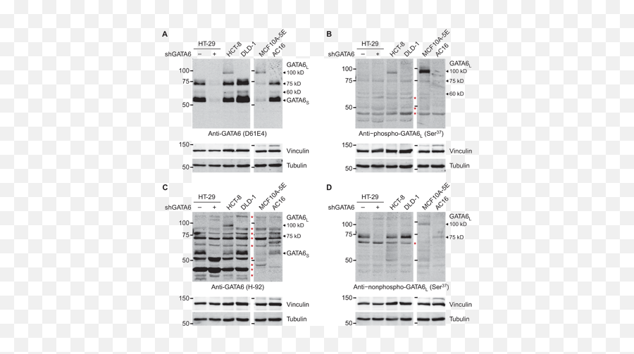 Tnf - Insulin Crosstalk At The Transcription Factor Gata6 Is Vertical Emoji,Emotion Kernel R24