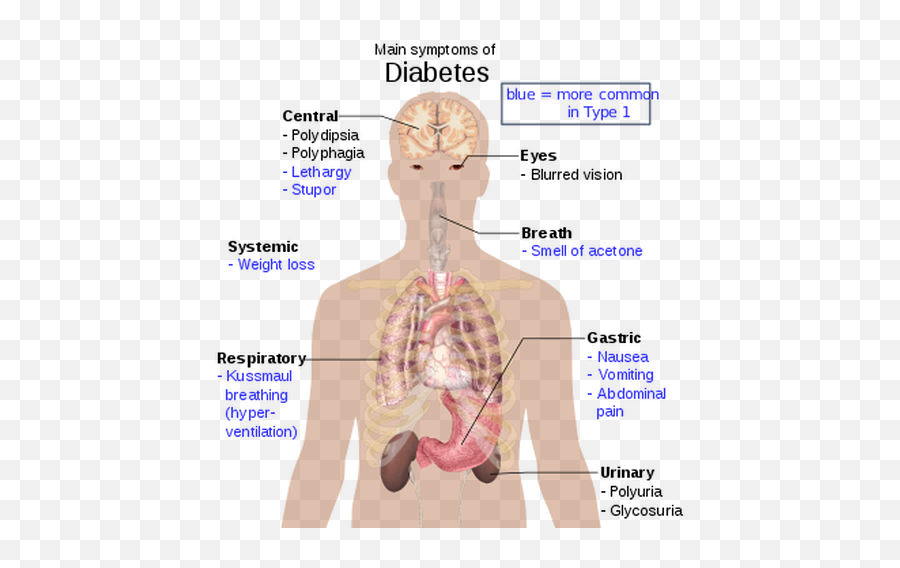 Modern Medicine - Welcome To Our Generation Usa Diabetes Mellitus Type 1 Emoji,Diabetes Emoticons