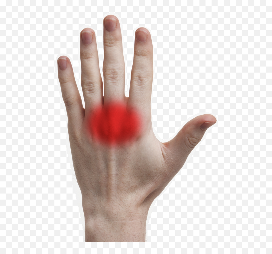 How To Approach Knuckle Pain In Gaming - Knuckle Pain Emoji,Ring.finger Pain Emotion