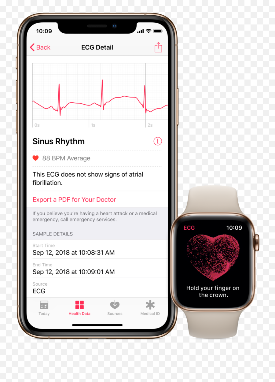 The Apple Watch Can Take Your Ekg Starting Today - Ecg Apple Watch Emoji,Bernese Mountain Dog Emoji