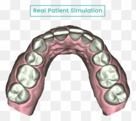 Results Smile2u - Dot Emoji,Gold Grill Smiles Emojis Gif