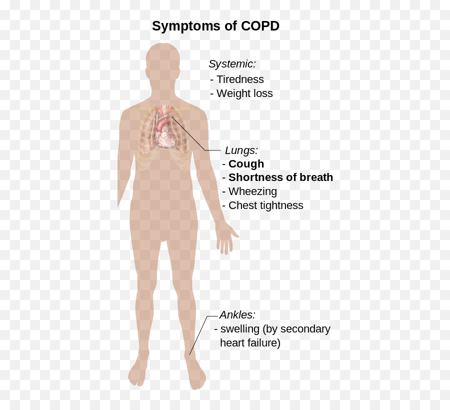 Chronic Obstructive Pulmonary Disease Copd Overview - Cop D Symptoms Emoji,Cannon-bard Theory Of Emotion
