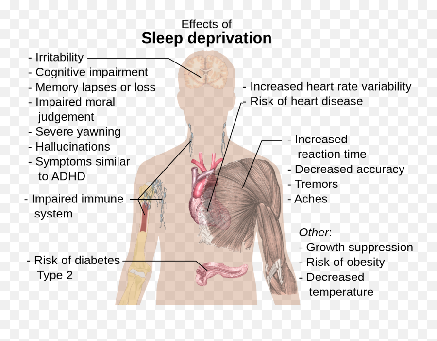 Sleep Debt - Effects Of Sleep Deprivation Emoji,Sleep Emotion