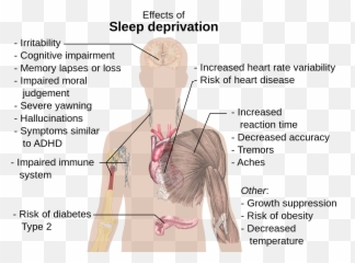 Sleep Debt - Effects Of Sleep Deprivation Emoji,Sleep Emotion