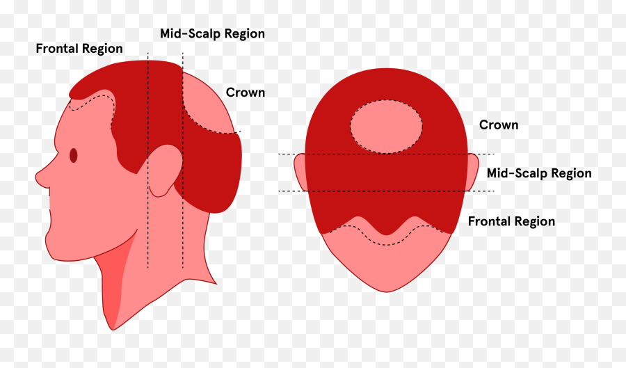 The 4 Regions Of The Scalp Keeps - Head Crown Emoji,List And Explain Three Componets Part Of Emotions