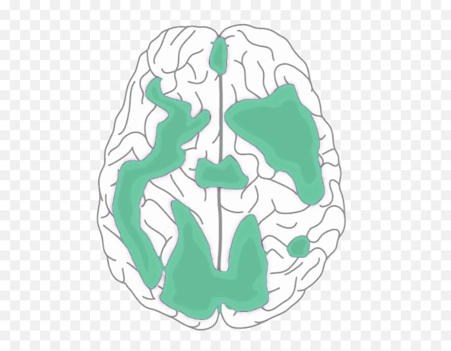 How Tms Works - Language Emoji,Meningioma Affects Areas Of Brain Right Occipital Emotions